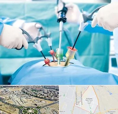 جراح فیبروم در اندیشه