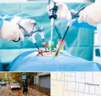 جراح فیبروم در خیابان فلسطین