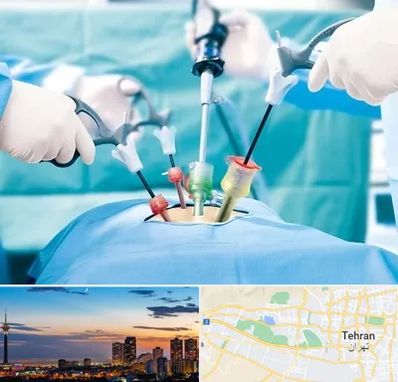 جراح فیبروم در غرب تهران