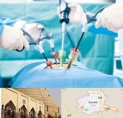 جراح فیبروم در ساوه