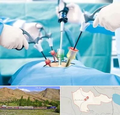 جراح فیبروم در خاش