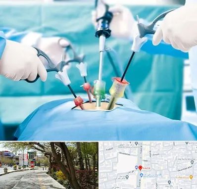 جراح فیبروم در خیابان توحید اصفهان