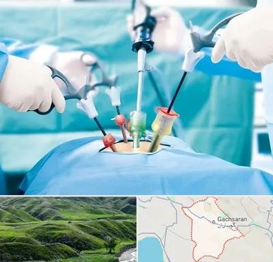 جراح فیبروم در گچساران