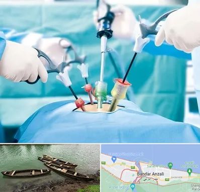 جراح فیبروم در بندر انزلی