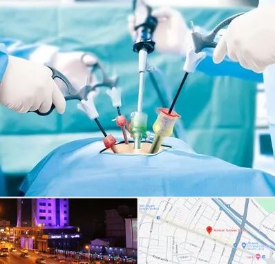 جراح فیبروم در آبرسان تبریز