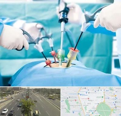 جراح فیبروم در منطقه 17 تهران