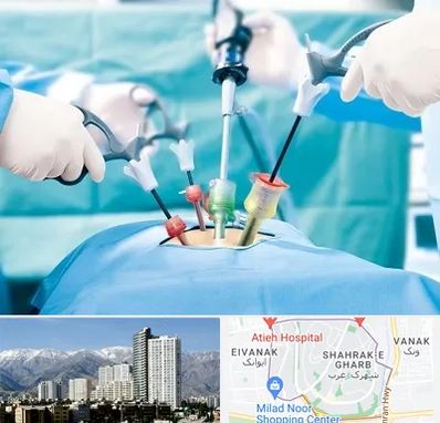 جراح فیبروم در شهرک غرب تهران