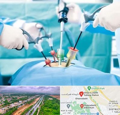 جراح فیبروم در قصرالدشت شیراز