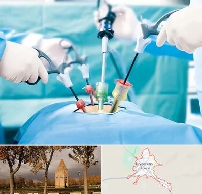 جراح فیبروم در تویسرکان