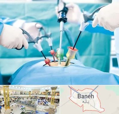 جراح فیبروم در بانه