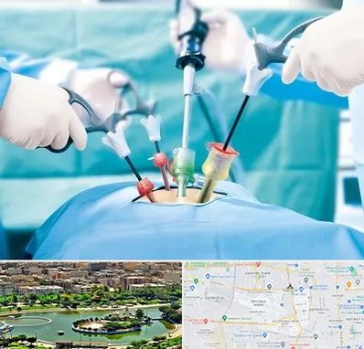 جراح فیبروم در منطقه 9 تهران