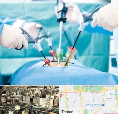 جراح فیبروم در مرزداران