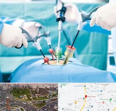 جراح فیبروم در سبلان