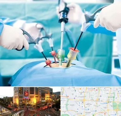 جراح فیبروم در جنت آباد تهران