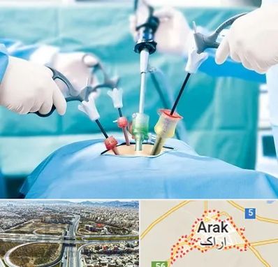 جراح فیبروم در اراک