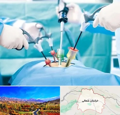 جراح فیبروم در خراسان شمالی
