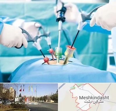 جراح فیبروم در مشکین دشت