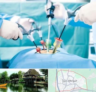 جراح فیبروم در صومعه سرا