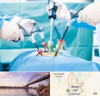 جراح فیبروم در اهواز