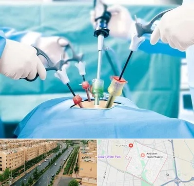 جراح فیبروم در فاز سه اندیشه