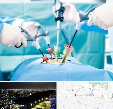 جراح فیبروم در هفت تیر مشهد