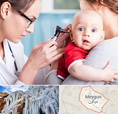 شنوایی سنجی نوزاد در میگون
