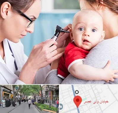 شنوایی سنجی نوزاد در ولیعصر شهریار