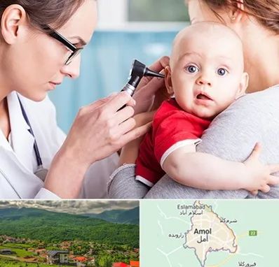 شنوایی سنجی نوزاد در آمل