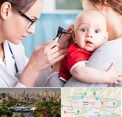 شنوایی سنجی نوزاد در منطقه 1 تهران 