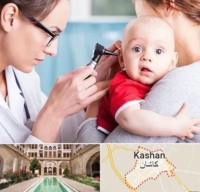 شنوایی سنجی نوزاد در کاشان