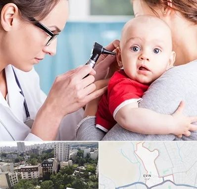 شنوایی سنجی نوزاد در اوین