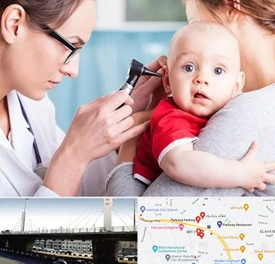 شنوایی سنجی نوزاد در پارک وی 