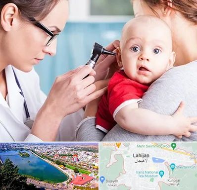 شنوایی سنجی نوزاد در لاهیجان