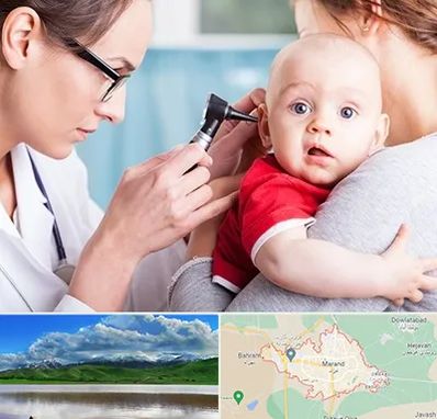 شنوایی سنجی نوزاد در مرند