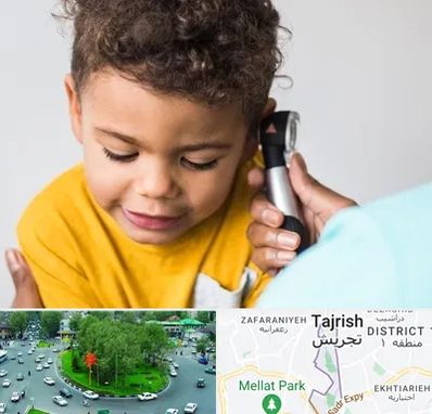 شنوایی سنجی کودکان در تجریش 