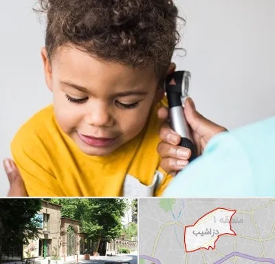 شنوایی سنجی کودکان در دزاشیب