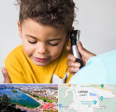 شنوایی سنجی کودکان در لاهیجان