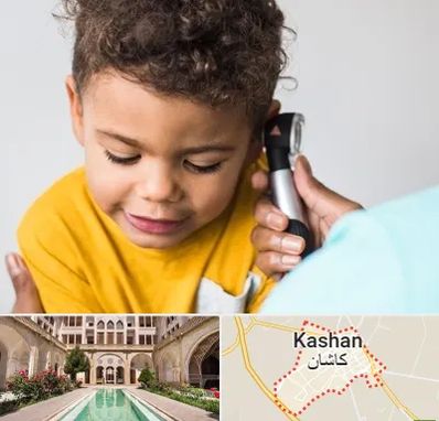 شنوایی سنجی کودکان در کاشان