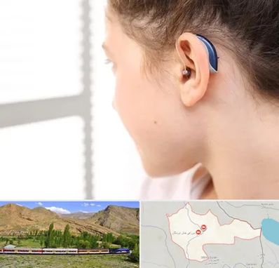 تجویز سمعک در خاش