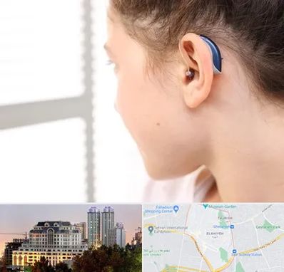 تجویز سمعک در فرشته 