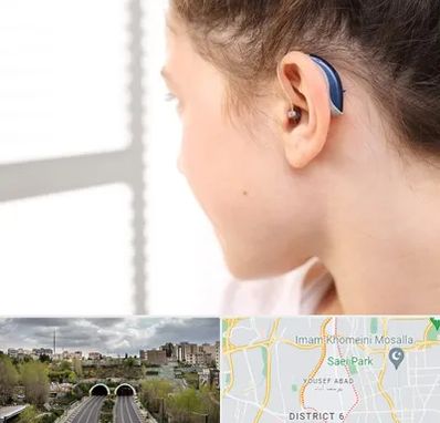 تجویز سمعک در یوسف آباد 