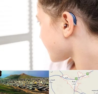 تجویز سمعک در بیجار