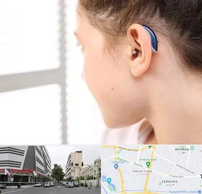 تجویز سمعک در بلوار فردوس 