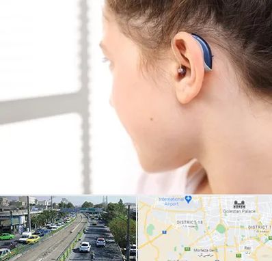 تجویز سمعک در جنوب تهران 