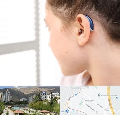 تجویز سمعک در شهر زیبا 