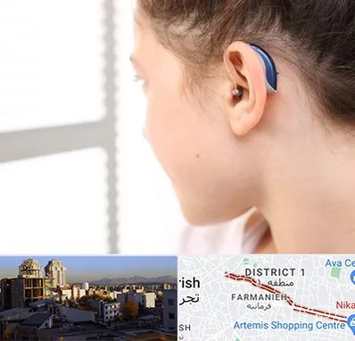 تجویز سمعک در فرمانیه 