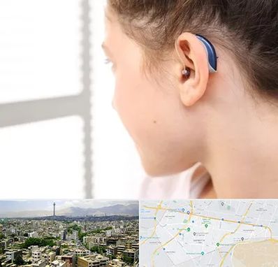 تجویز سمعک در منطقه 8 تهران 