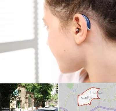 تجویز سمعک در دزاشیب