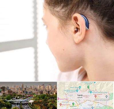 تجویز سمعک در منطقه 1 تهران 