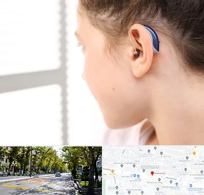 تجویز سمعک در میرداماد 